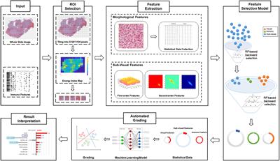 Machine Learning Models for Multiparametric Glioma Grading With Quantitative Result Interpretations